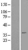 HEY1 Human Over-expression Lysate