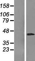 RHBDD3 Human Over-expression Lysate