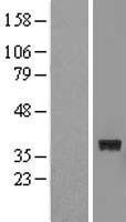 FTSJ1 Human Over-expression Lysate