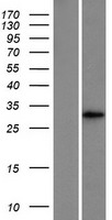 MMD Human Over-expression Lysate