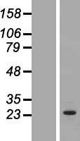 OSTF1 Human Over-expression Lysate
