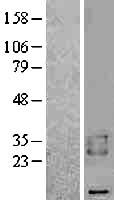 BAMBI Human Over-expression Lysate