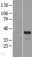 SPDEF Human Over-expression Lysate