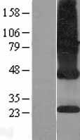 CMT (ICMT) Human Over-expression Lysate