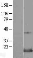 SNAPIN Human Over-expression Lysate