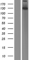 STAG3 Human Over-expression Lysate
