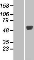TBL2 Human Over-expression Lysate