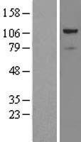 ANT 1 (PRPF6) Human Over-expression Lysate