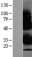 WBP1 Human Over-expression Lysate