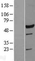 DNAAF11 Human Over-expression Lysate