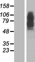 Presenilin 2 (PSEN2) Human Over-expression Lysate
