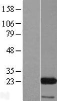 EIF3K Human Over-expression Lysate