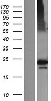 GTL3 (CFAP20) Human Over-expression Lysate