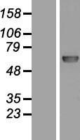 DNA Polymerase lambda (POLL) Human Over-expression Lysate