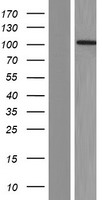 RBM15B Human Over-expression Lysate