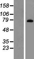 PADI1 Human Over-expression Lysate