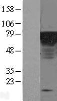 Epsin 1 (EPN1) Human Over-expression Lysate