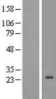 C16orf5 (CDIP1) Human Over-expression Lysate