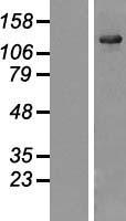 USP25 Human Over-expression Lysate