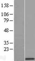 Cytochrome b c1 complex subunit 9 (UQCR10) Human Over-expression Lysate