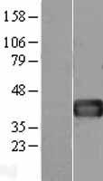 Follistatin (FST) Human Over-expression Lysate
