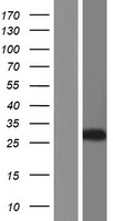 AK2 Human Over-expression Lysate