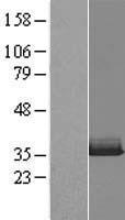 VCX Human Over-expression Lysate