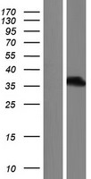 PAX8 Human Over-expression Lysate