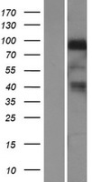 NRG1 Human Over-expression Lysate