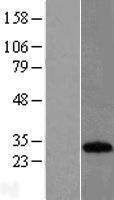 CSEN (KCNIP3) Human Over-expression Lysate