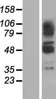 ZBTB43 Human Over-expression Lysate