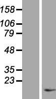 TAC1 Human Over-expression Lysate