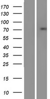 SSX2IP Human Over-expression Lysate