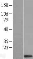 DEXI Human Over-expression Lysate