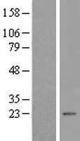 Malignant T cell amplified sequence 1 (MCTS1) Human Over-expression Lysate