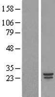 COMMD5 Human Over-expression Lysate
