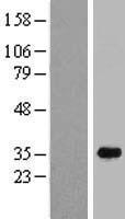 C16orf72 Human Over-expression Lysate