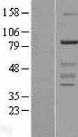 WDR91 Human Over-expression Lysate