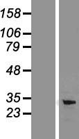 PD-L1 (CD274) Human Over-expression Lysate