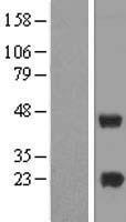 METTL7A Human Over-expression Lysate