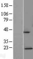 NDUFAF4 Human Over-expression Lysate