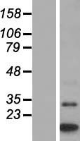 MTCP1 Human Over-expression Lysate