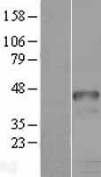 HOXD9 Human Over-expression Lysate