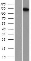 TDRD7 Human Over-expression Lysate