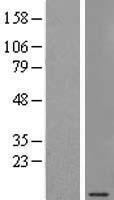 SEC61G Human Over-expression Lysate
