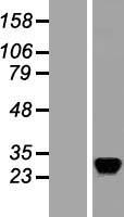 RASD2 Human Over-expression Lysate