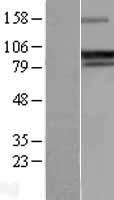 GADD34 (PPP1R15A) Human Over-expression Lysate