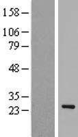 EID1 Human Over-expression Lysate