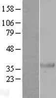 NKX2.8 (NKX2-8) Human Over-expression Lysate