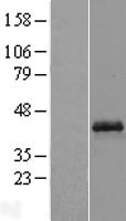 Opticin (OPTC) Human Over-expression Lysate